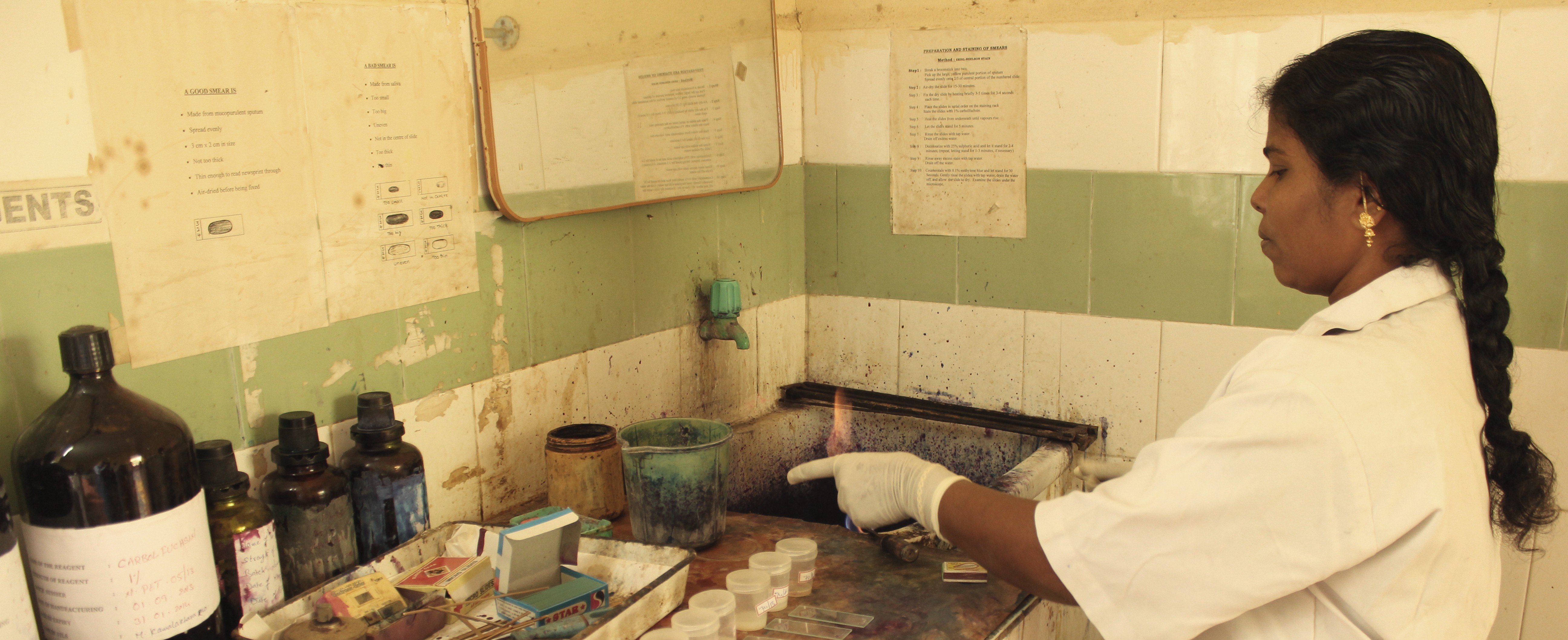 TB diagnostic technician in India